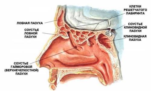 Хронический гайморит Хронический гайморит